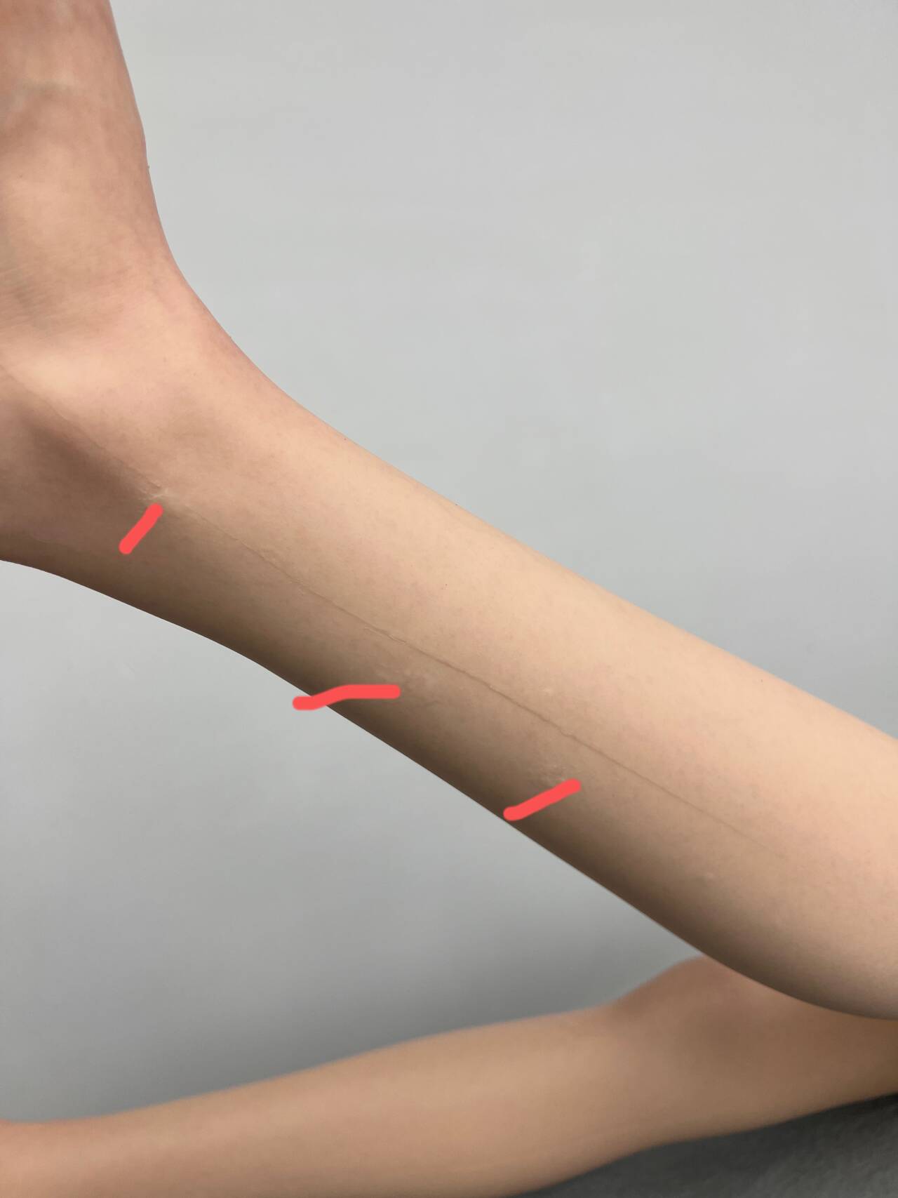 AIBEI | Slightly Flawed 167cm/5ft6 E-Cup Silicone Bodies – 40% OFF White Skin